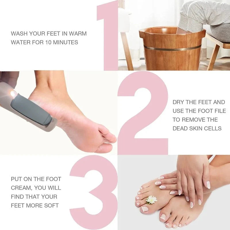 Electric Foot Callus Remover